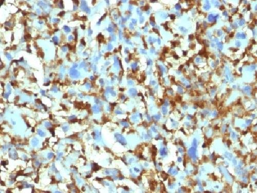 Immunohistochemistry (Formalin/PFA-fixed paraffin-embedded sections) - Anti-Factor XIIIa antibody [F13A1/1448] (AB218392), expandable thumbnail
