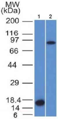 Western blot - Anti-Factor XIIIa antibody [F13A1/1448] (AB218392), expandable thumbnail