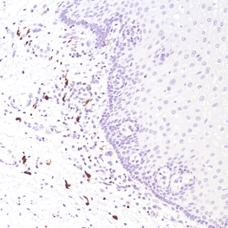 Immunohistochemistry (Formalin/PFA-fixed paraffin-embedded sections) - Anti-Factor XIIIa antibody [SP196] (AB225722)
