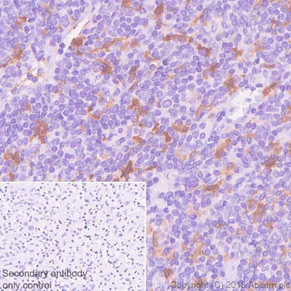 Immunohistochemistry (Formalin/PFA-fixed paraffin-embedded sections) - Anti-Factor XIIIa antibody [SP196] (AB225722)
