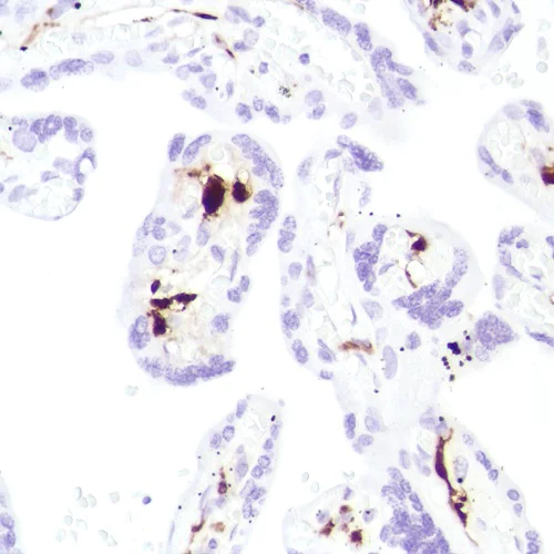 Immunohistochemistry (Formalin/PFA-fixed paraffin-embedded sections) - Anti-Factor XIIIa antibody [SP196] (AB225722)