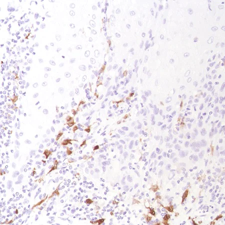 Immunohistochemistry (Formalin/PFA-fixed paraffin-embedded sections) - Anti-Factor XIIIa antibody [SP196] (AB225722)