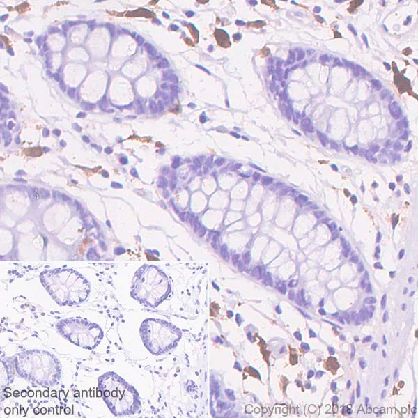 Immunohistochemistry (Formalin/PFA-fixed paraffin-embedded sections) - Anti-Factor XIIIa antibody [SP196] (AB225722)