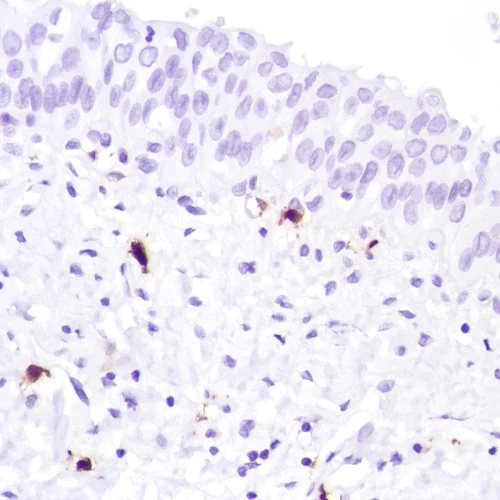 Immunohistochemistry (Formalin/PFA-fixed paraffin-embedded sections) - Anti-Factor XIIIa antibody [SP196] (AB225722)