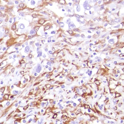 Immunohistochemistry (Formalin/PFA-fixed paraffin-embedded sections) - Anti-Factor XIIIa antibody [SP196] - BSA and Azide free (AB245757)