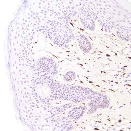 Immunohistochemistry (Formalin/PFA-fixed paraffin-embedded sections) - Anti-Factor XIIIa antibody [SP196] - BSA and Azide free (AB245757)