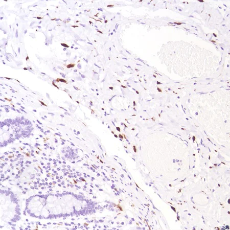 Immunohistochemistry (Formalin/PFA-fixed paraffin-embedded sections) - Anti-Factor XIIIa antibody [SP196] - BSA and Azide free (AB245757)