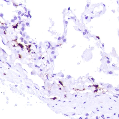Immunohistochemistry (Formalin/PFA-fixed paraffin-embedded sections) - Anti-Factor XIIIa antibody [SP196] - BSA and Azide free (AB245757)