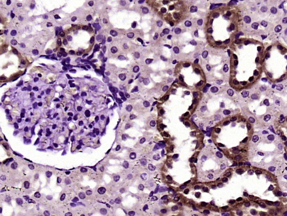 Immunohistochemistry (Formalin/PFA-fixed paraffin-embedded sections) - Anti-FADD antibody (AB216506)