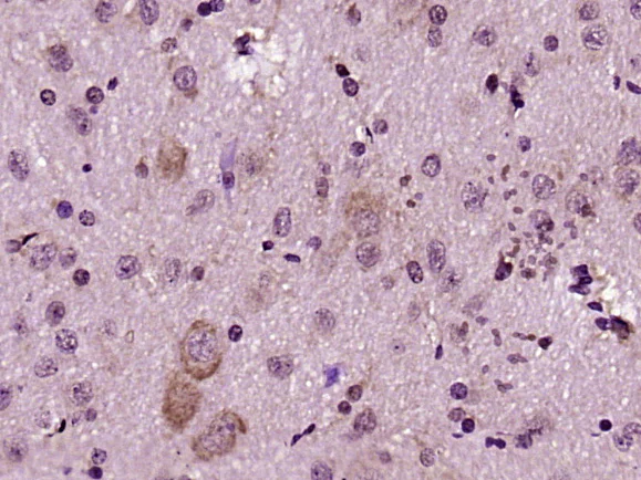 Immunohistochemistry (Formalin/PFA-fixed paraffin-embedded sections) - Anti-FADD antibody (AB216506)