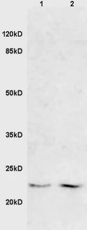 Western blot - Anti-FADD antibody (AB216506)