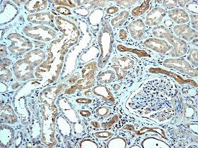 Immunohistochemistry (Formalin/PFA-fixed paraffin-embedded sections) - Anti-FADD antibody [EPR4415] (AB108601), expandable thumbnail