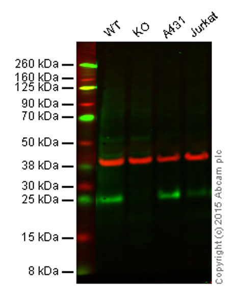 Western blot - Anti-FADD antibody [EPR4415] (AB108601), expandable thumbnail