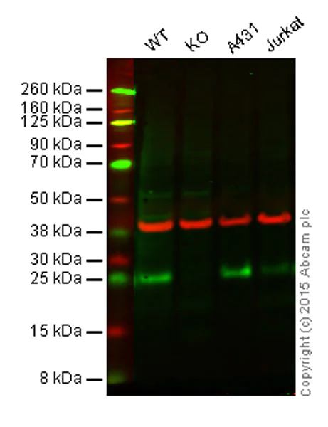 Western blot - Anti-FADD antibody [EPR4415] (AB108601)