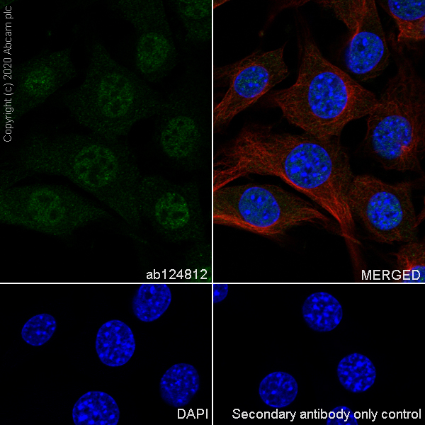 Immunocytochemistry/ Immunofluorescence - Anti-FADD antibody [EPR5030] (AB124812), expandable thumbnail