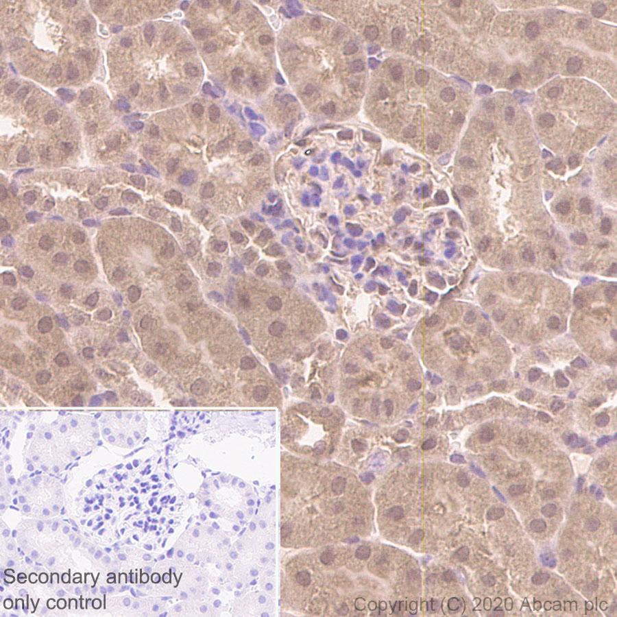 Immunohistochemistry (Formalin/PFA-fixed paraffin-embedded sections) - Anti-FADD antibody [EPR5030] (AB124812), expandable thumbnail