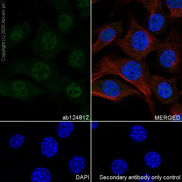 Immunocytochemistry/ Immunofluorescence - Anti-FADD antibody [EPR5030] - BSA and Azide free (AB229444)