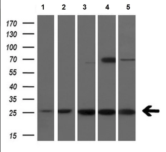 Western blot - Anti-FADD antibody [OTI1C11] (AB119059)