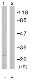 Western blot - Anti-FADD (phospho S194) antibody (AB55334), expandable thumbnail