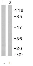 Western blot - Anti-FADD (phospho S194) antibody (AB55334)