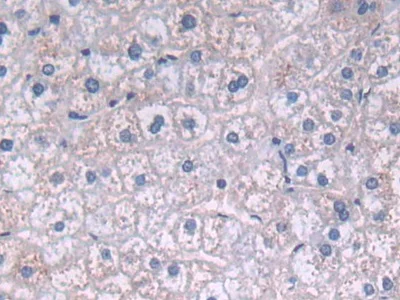 Immunohistochemistry (Formalin/PFA-fixed paraffin-embedded sections) - Anti-FADS2 antibody (AB232898)