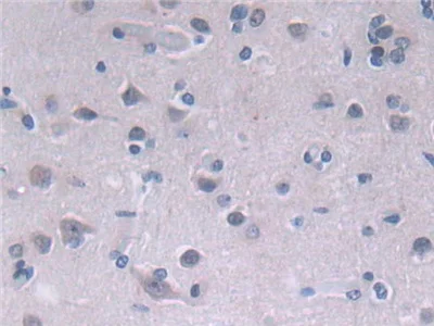 Immunohistochemistry (Formalin/PFA-fixed paraffin-embedded sections) - Anti-FADS2 antibody (AB232898)