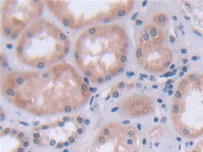 Immunohistochemistry (Formalin/PFA-fixed paraffin-embedded sections) - Anti-FADS2 antibody (AB232898)