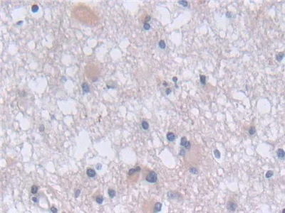 Immunohistochemistry (Formalin/PFA-fixed paraffin-embedded sections) - Anti-FADS2 antibody (AB232898)