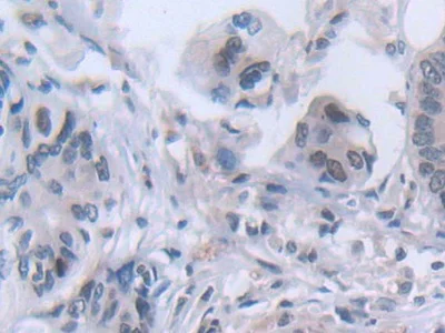 Immunohistochemistry (Formalin/PFA-fixed paraffin-embedded sections) - Anti-FADS2 antibody (AB232898)