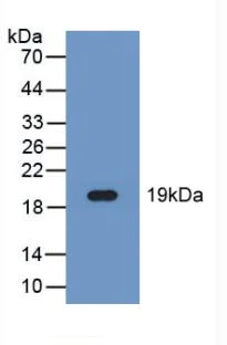 Western blot - Anti-FADS2 antibody (AB232898)