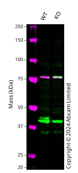 Western blot - Anti-FADS2 antibody (AB72189)