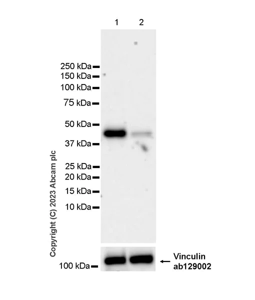 Western blot - Anti-FADS2 antibody [EPR27357-82] - BSA and Azide free (AB314318)