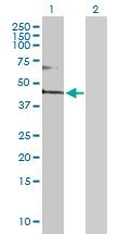 Western blot - Anti-FADS3 antibody (AB169342), expandable thumbnail