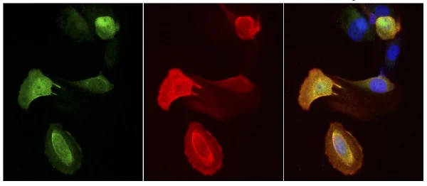 Immunocytochemistry/ Immunofluorescence - Anti-FAF1 antibody (AB202298)