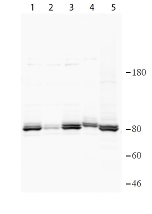 Western blot - Anti-FAF1 antibody (AB202298), expandable thumbnail
