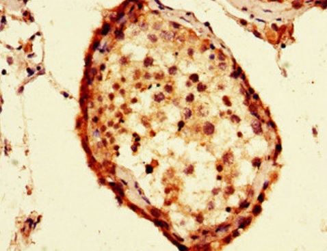 Immunohistochemistry (Formalin/PFA-fixed paraffin-embedded sections) - Anti-FAF1 antibody (AB222907)
