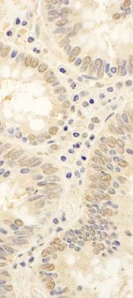 Immunohistochemistry (Formalin/PFA-fixed paraffin-embedded sections) - Anti-FAF1 antibody (AB225556)