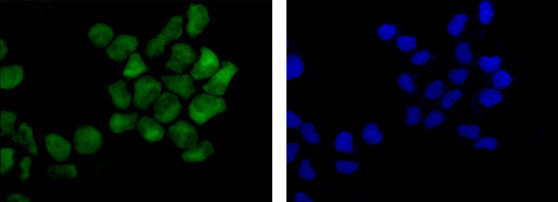 Immunocytochemistry/ Immunofluorescence - Anti-FAF1 antibody [EPR14754] (AB183045)