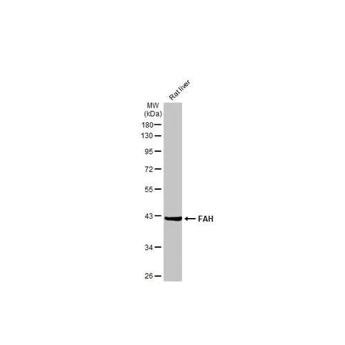 Western blot - Anti-FAH antibody [HL1970] (AB317120)