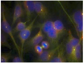 Immunocytochemistry/ Immunofluorescence - Anti-FAK antibody (AB131435), expandable thumbnail