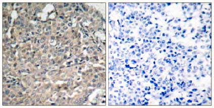 Immunohistochemistry (Formalin/PFA-fixed paraffin-embedded sections) - Anti-FAK antibody (AB131435), expandable thumbnail