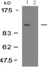 Western blot - Anti-FAK antibody (AB131435), expandable thumbnail