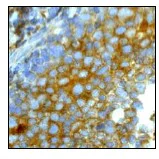 Immunohistochemistry (Formalin/PFA-fixed paraffin-embedded sections) - Anti-FAK antibody [EP1831Y] (AB76496)