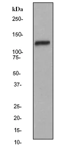 Western blot - Anti-FAK antibody [EP1831Y] (AB76496)