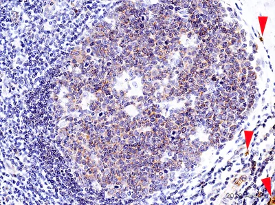 Immunohistochemistry (Formalin/PFA-fixed paraffin-embedded sections) - Anti-FAK antibody [EP695Y] (AB40794)