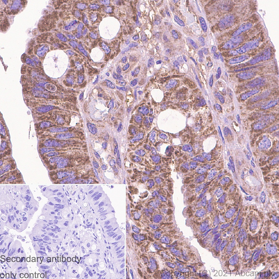 Immunohistochemistry (Formalin/PFA-fixed paraffin-embedded sections) - Anti-FAK antibody [EP695Y] (AB40794)
