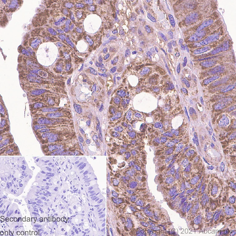 Immunohistochemistry (Formalin/PFA-fixed paraffin-embedded sections) - Anti-FAK antibody [EP695Y] (AB40794)