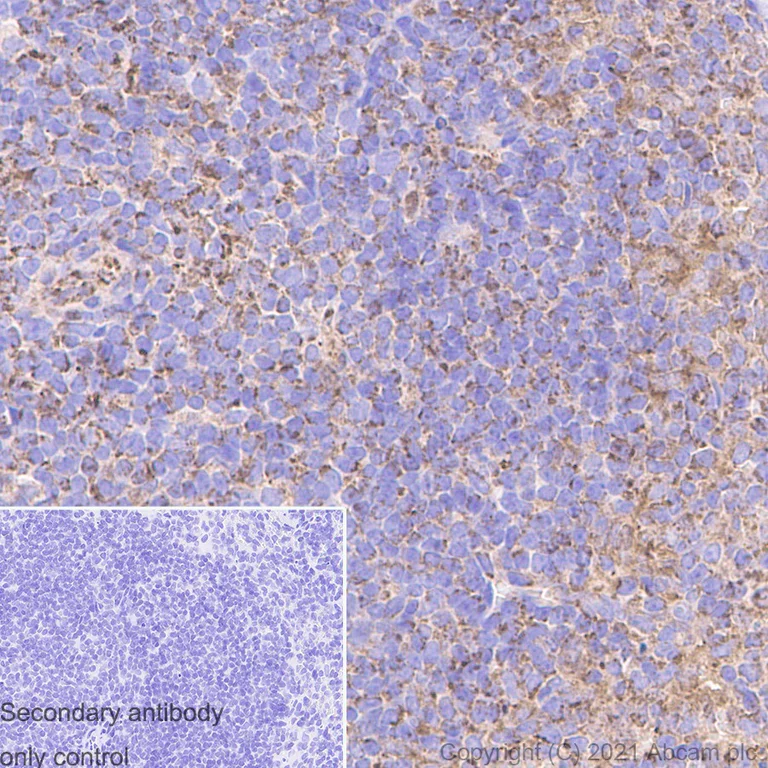 Immunohistochemistry (Formalin/PFA-fixed paraffin-embedded sections) - Anti-FAK antibody [EP695Y] (AB40794)