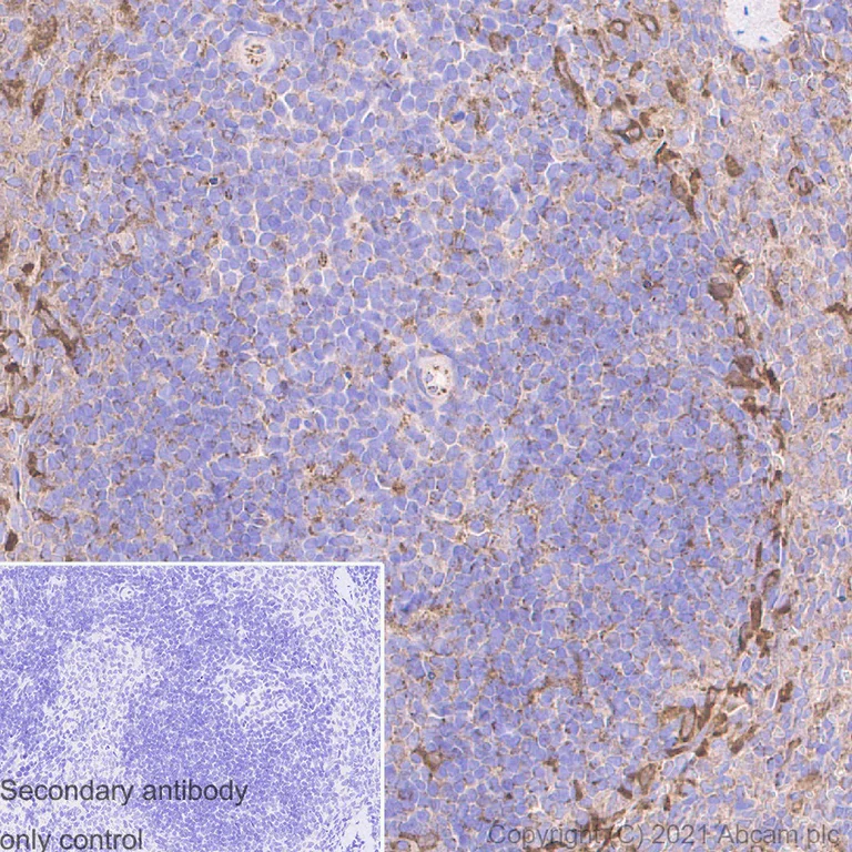 Immunohistochemistry (Formalin/PFA-fixed paraffin-embedded sections) - Anti-FAK antibody [EP695Y] (AB40794)