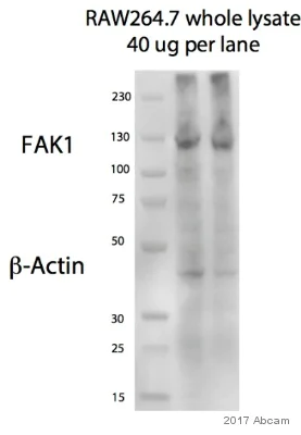Western blot - Anti-FAK antibody [EP695Y] (AB40794)